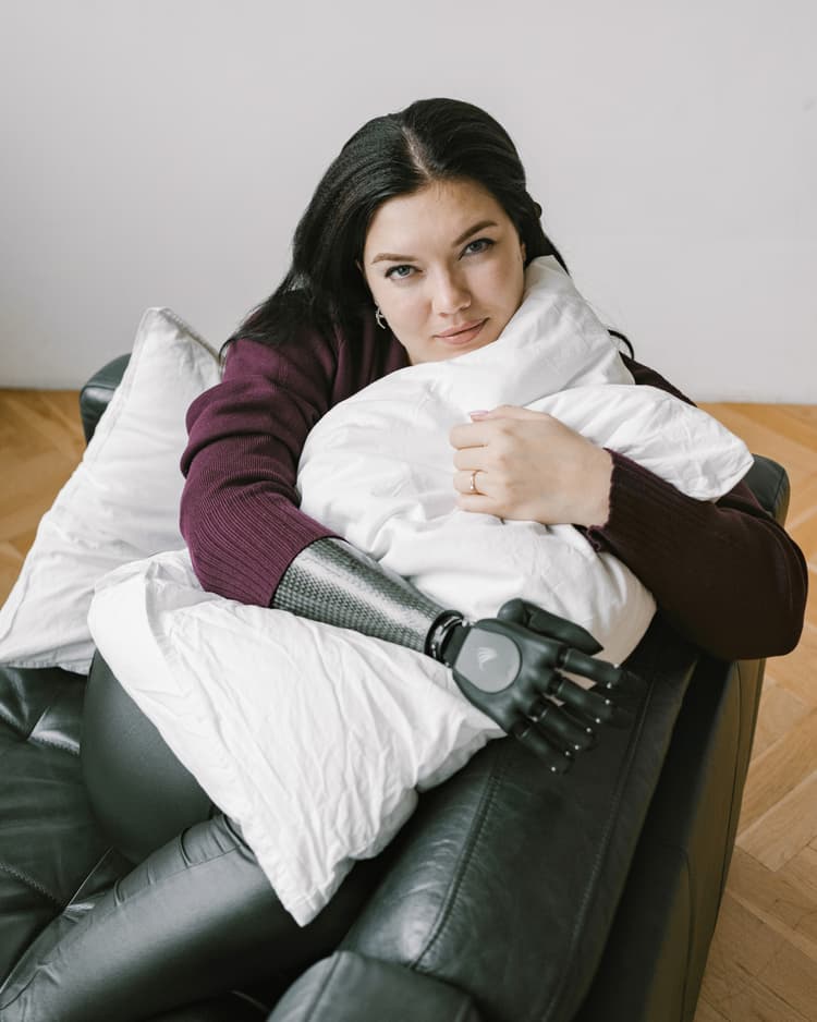 Протезирование рук 