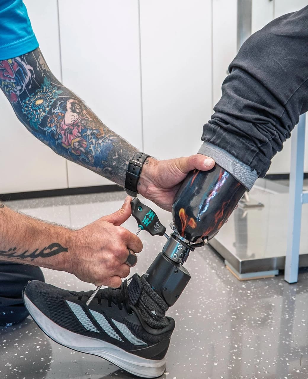 Лечение положением: протезирование голени