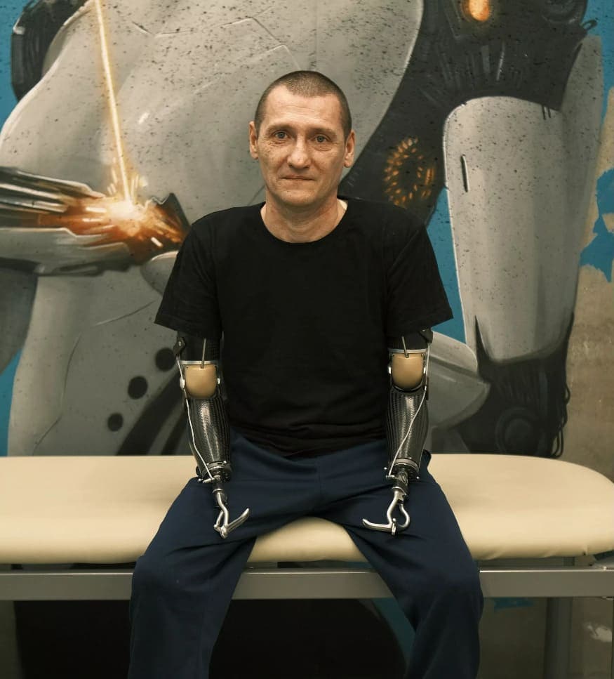 Благодаря поддержке фонда ВМП Сергей получил удобные и функциональные протезы