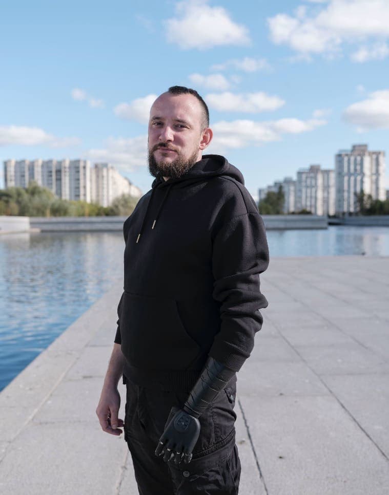 Готовимся к протезированию предплечья
