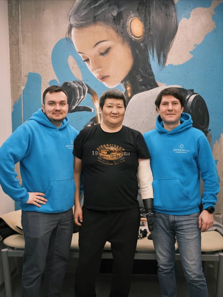 Протез руки для чемпиона по стрельбе